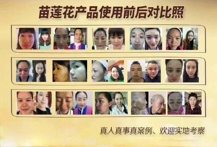苗莲花产品使用前后对比照合集