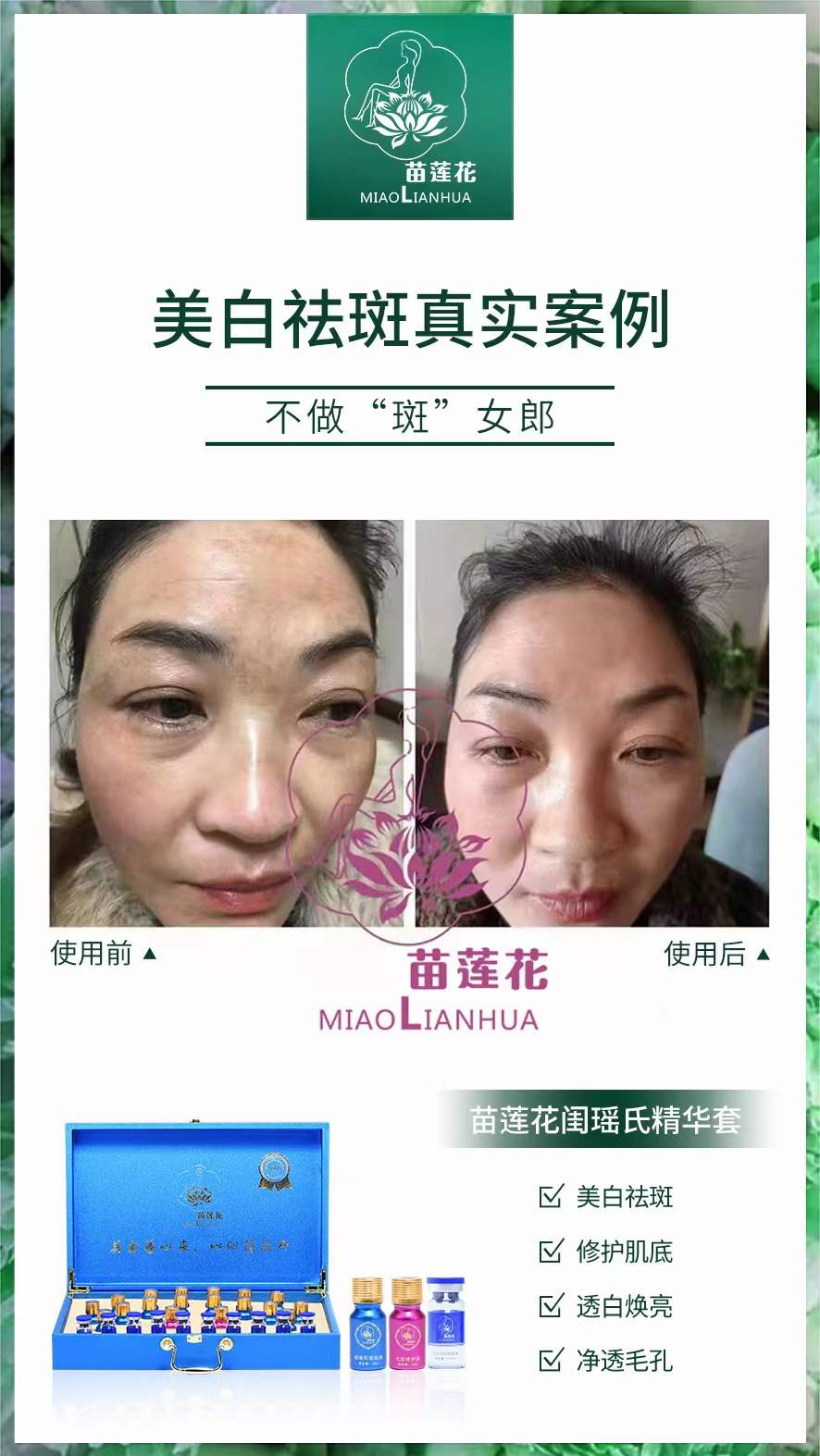 苗莲花祛斑真实案例