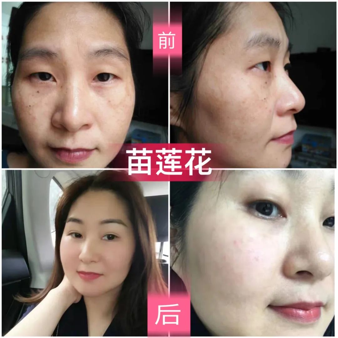 苗莲花优秀代理
