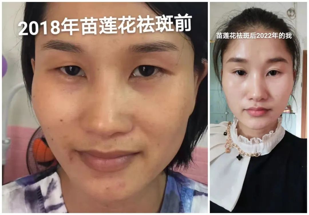 苗莲花代理商