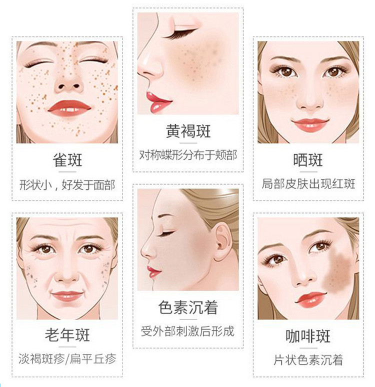 为什么年纪轻轻就长斑？这是你必须了解的色斑知识！
