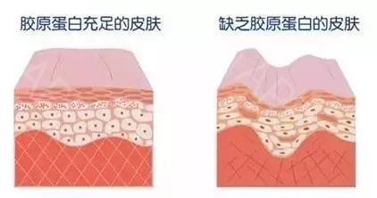 {xunruicms_img_title}