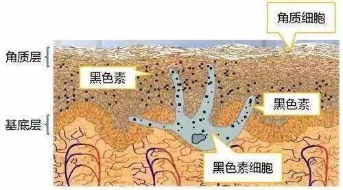 祛斑