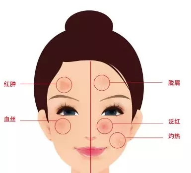 烂脸一直好不了？请用心看完这一篇
