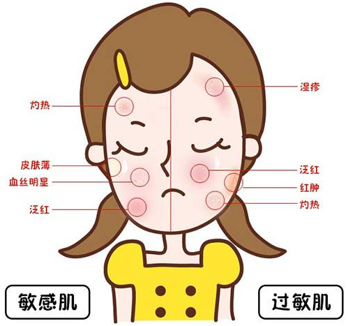 春敏季 | 痒！痒！痒！敏感≠过敏，傻傻分不清就等着烂脸咯~