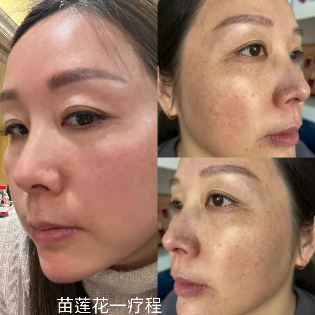 蒋春莲案例