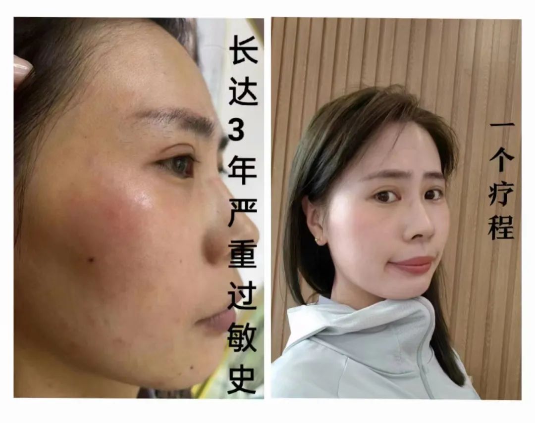 朱莉案例