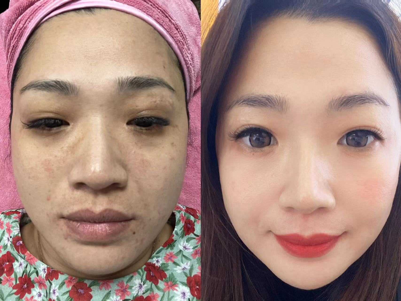 苗莲花专访|王静：美业梦想生根发芽，全力以赴事业开花结果！