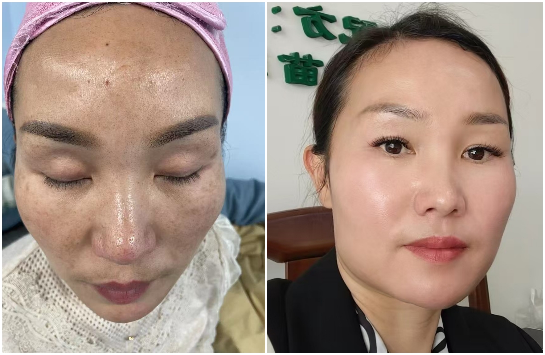 苗莲花专访 | 张利方：告别衰老焦虑，拿捏时间，更拿捏未来“致富密码”！