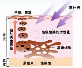 祛斑“翻车”？你懂什么是色沉和反黑吗？