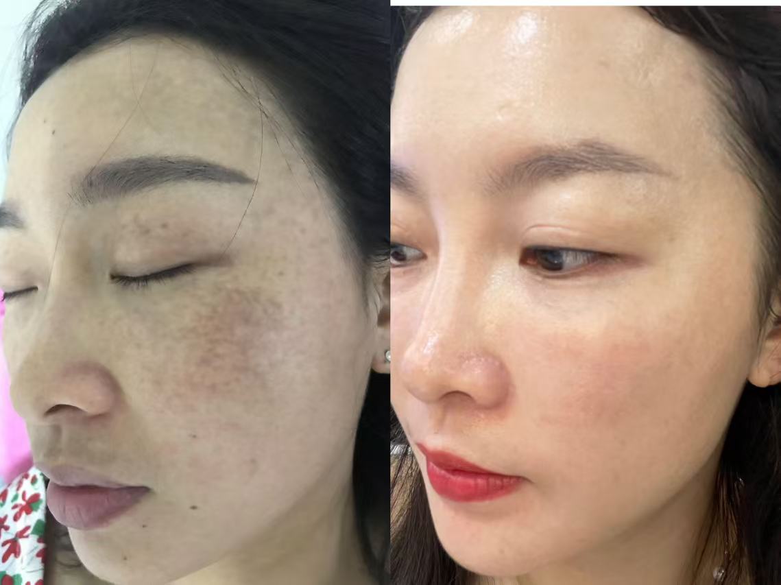 苗莲花专访 | 邹慧：探索美业之路，传递美丽能量，点亮闪耀人生！