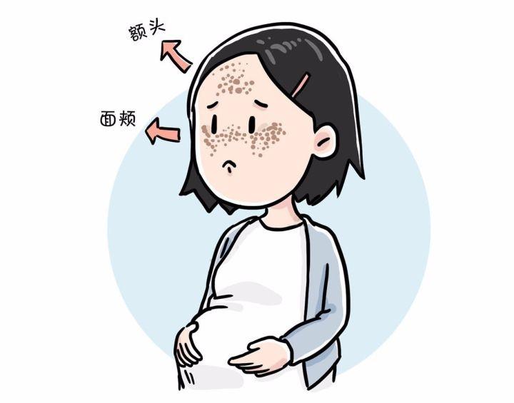 别再无视！斑点“野蛮生长”，元凶你每天都在接触