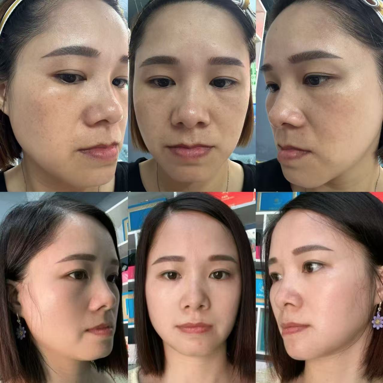 苗莲花专访 | 肖伟英：让美丽触手可及，让他人收获自信光芒