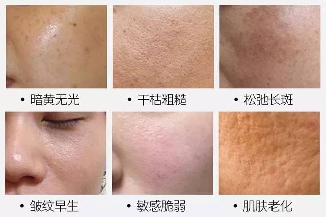 25+后皮肤越养越糙？做对这3件事真的很管用！