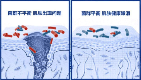 别再怪护肤品！皮肤总出问题，根源可能是菌群失调