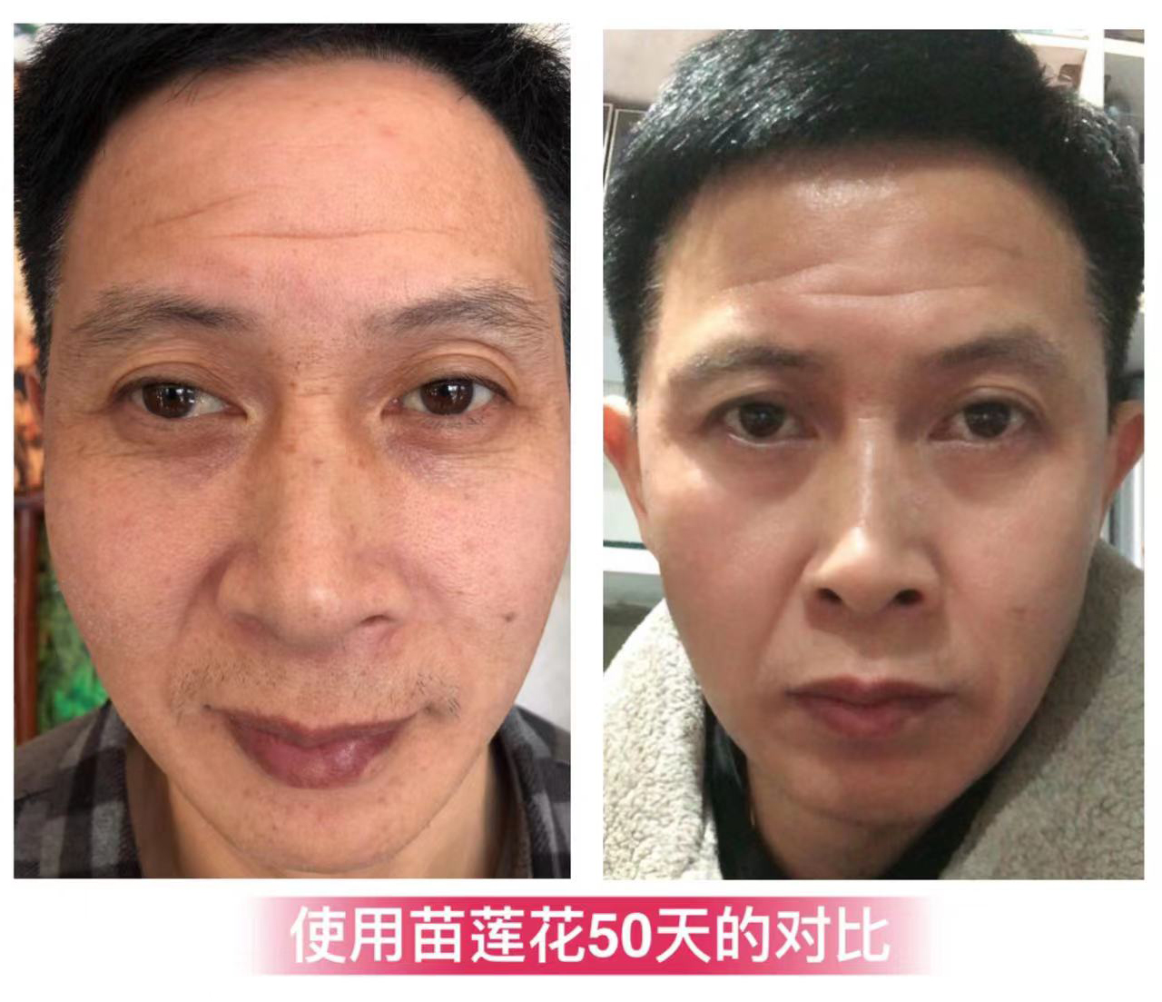 苗莲花专访黄桂胜 | 屡次失败，是重蹈覆辙还是破局再战？真的勇士这样做！