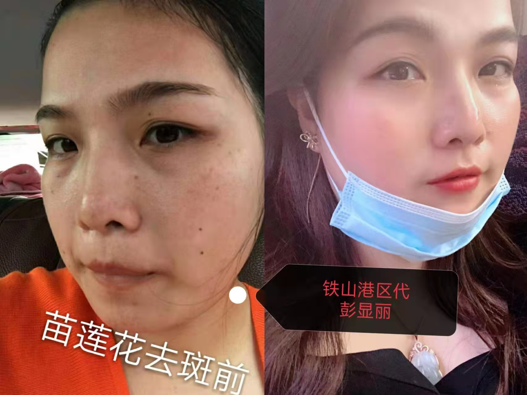 苗莲花专访 | 彭显丽：负债百万怎么活？从至暗到重生，她改写了人生剧本
