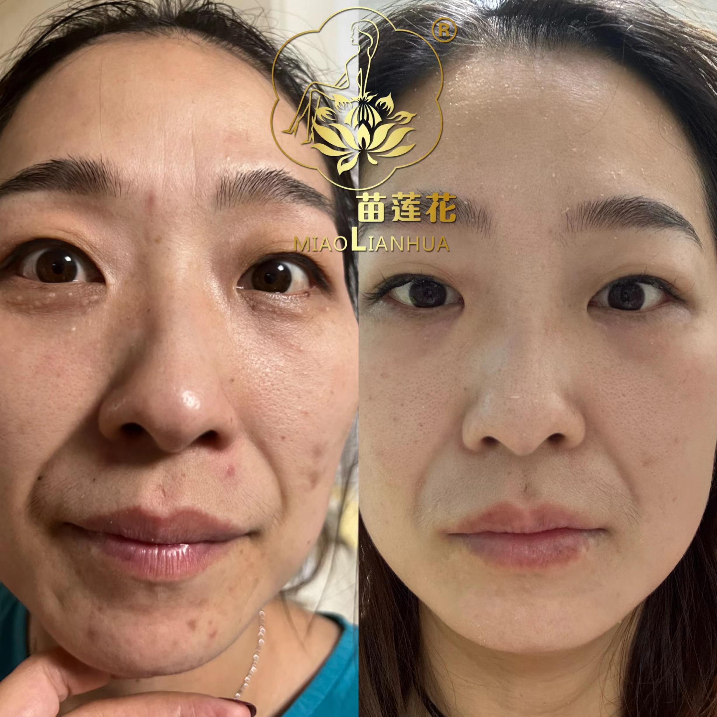 苗莲花专访 | 陈思敏：打破局限逐梦美业！在专业舞台寻得人生价值，圆满儿时梦